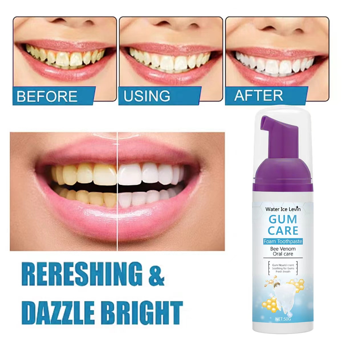 Water Ice Levin Gum Care Foam  - Teeth Whitening Xylitol Gum review and price