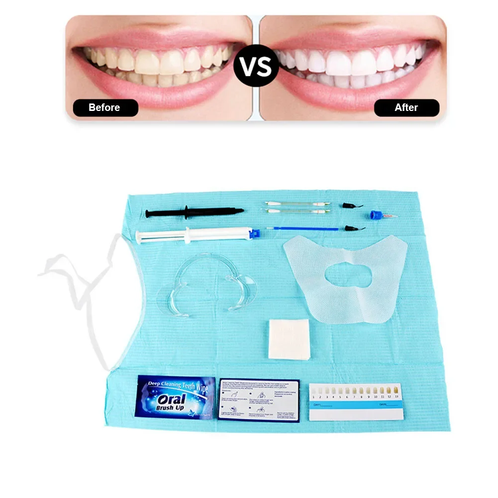 Dentist Clinic Teeth Whitening - Teeth Whitening Bleaching Kit review and price