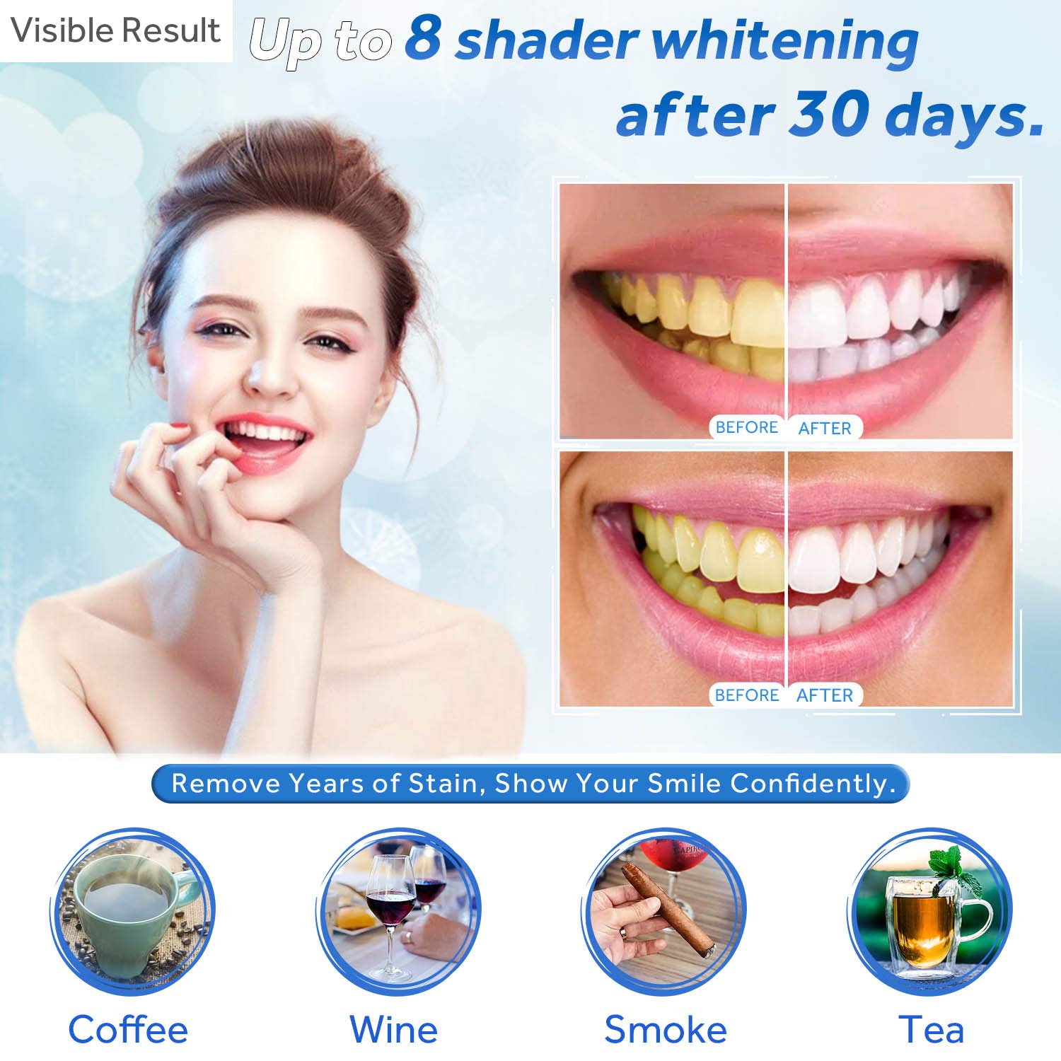 Teeth Whitening Gel Refill Syr - Teeth Whitening Bleaching Kit review and price