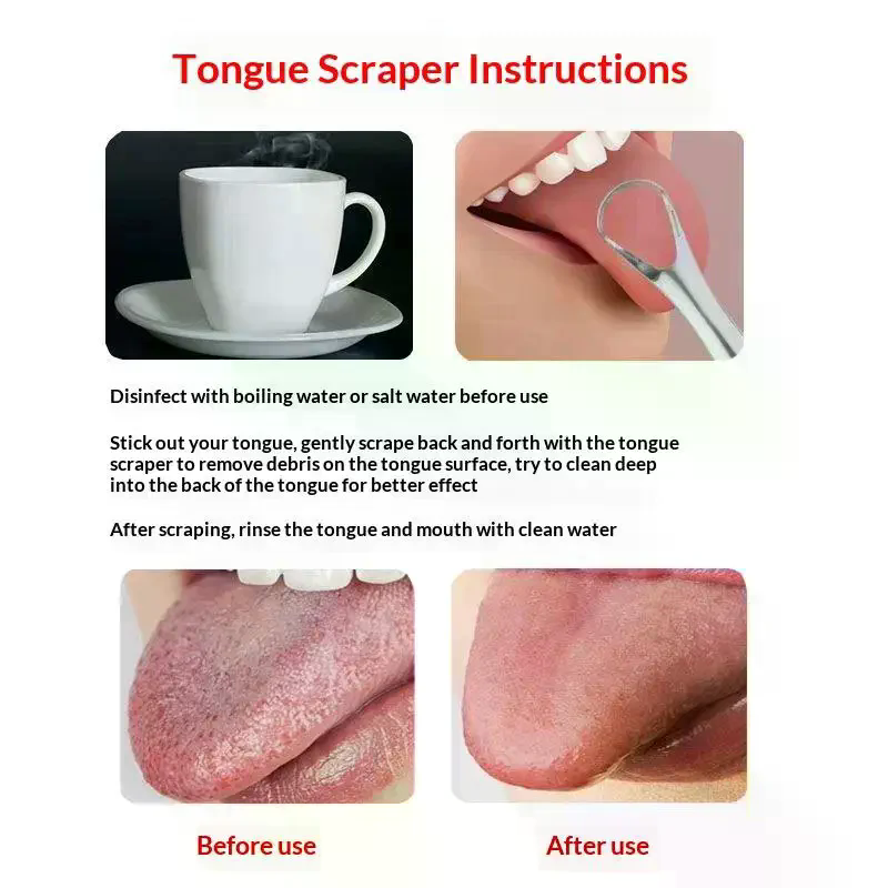 Stainless Steel Tongue Scraper - Tongue Scraper Metal review and price
