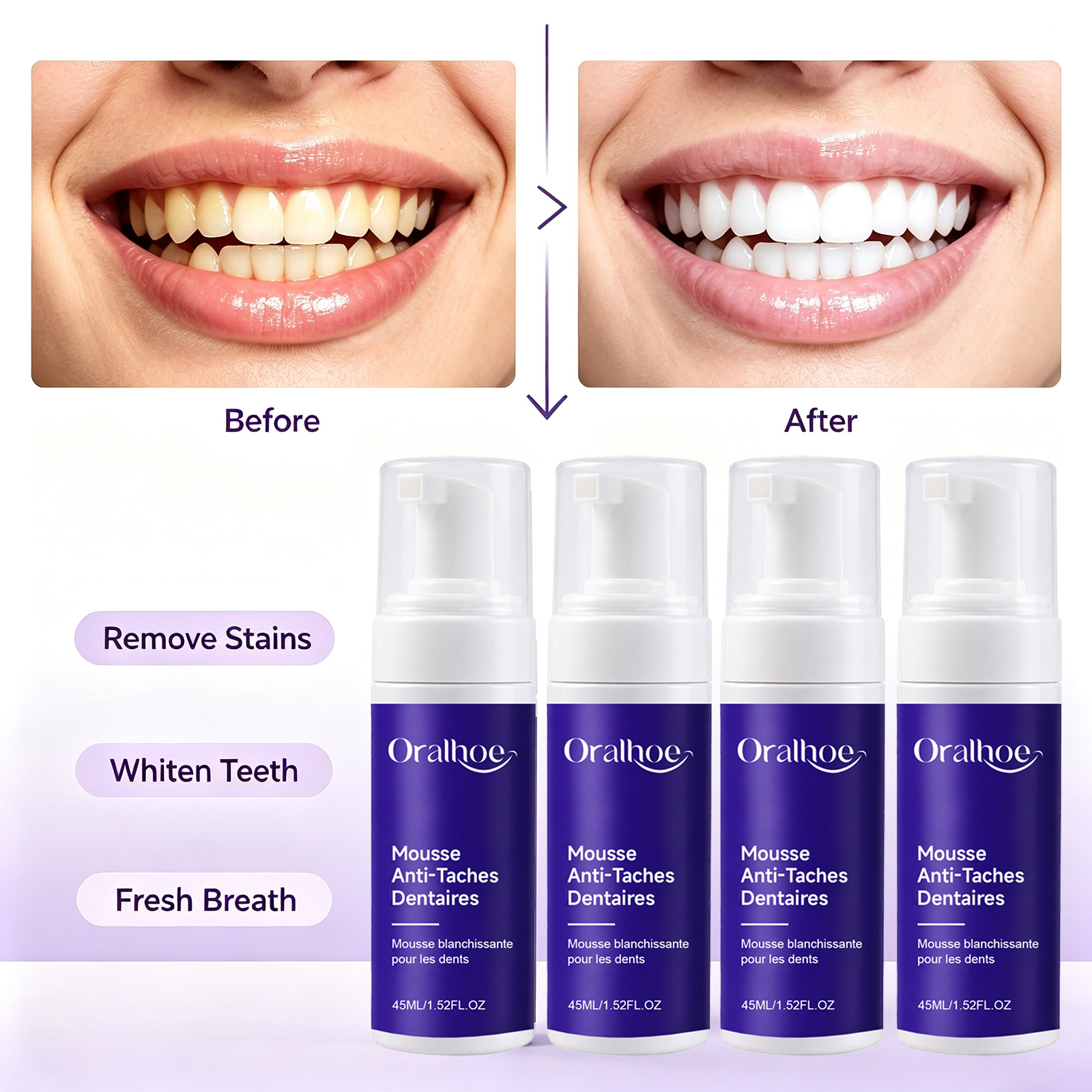 Purple Foaming Teeth Whitening - Teeth Whitening Routine review and price