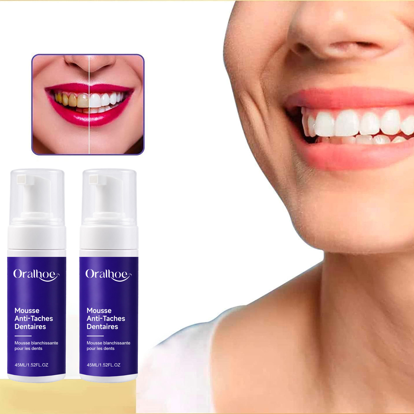 Purple Foaming Teeth Whitening - Teeth Whitening Routine review and price