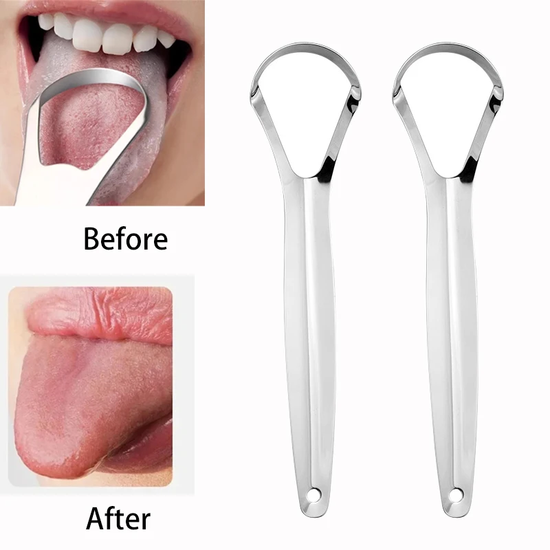 Halitosis Tongue Coating Tongu - Tongue Scraper Metal review and price