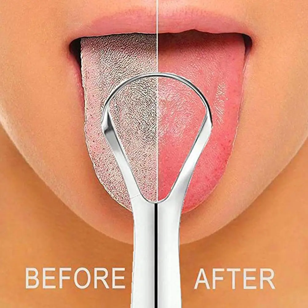 1-20pc Tongue Scraper, Stainle - Tongue Scraper Metal review and price