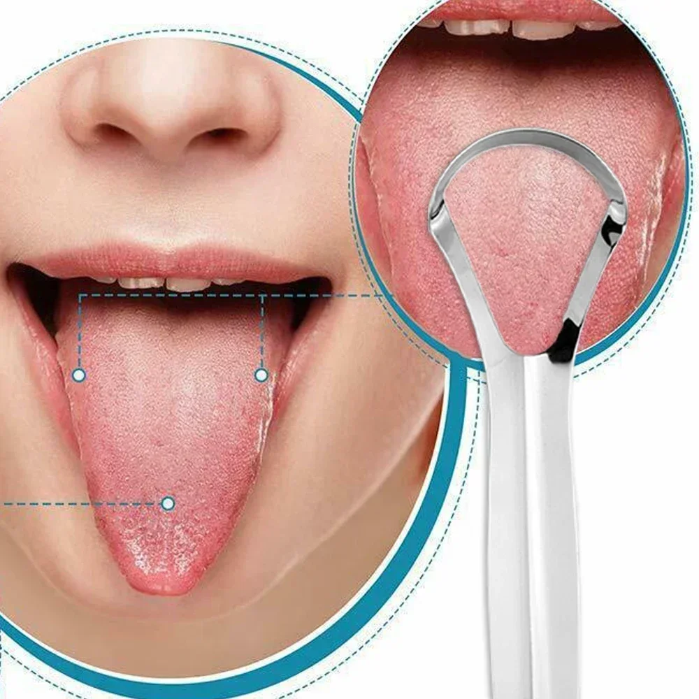 1-20pc Tongue Scraper, Stainle - Tongue Scraper Metal review and price