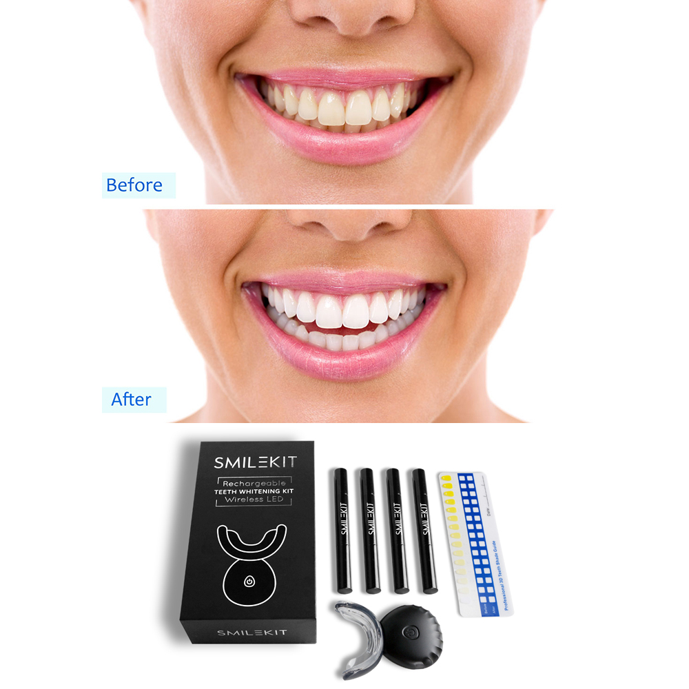 New Electric Teeth Whitening L - Teeth Whitening Bleaching Kit review and price