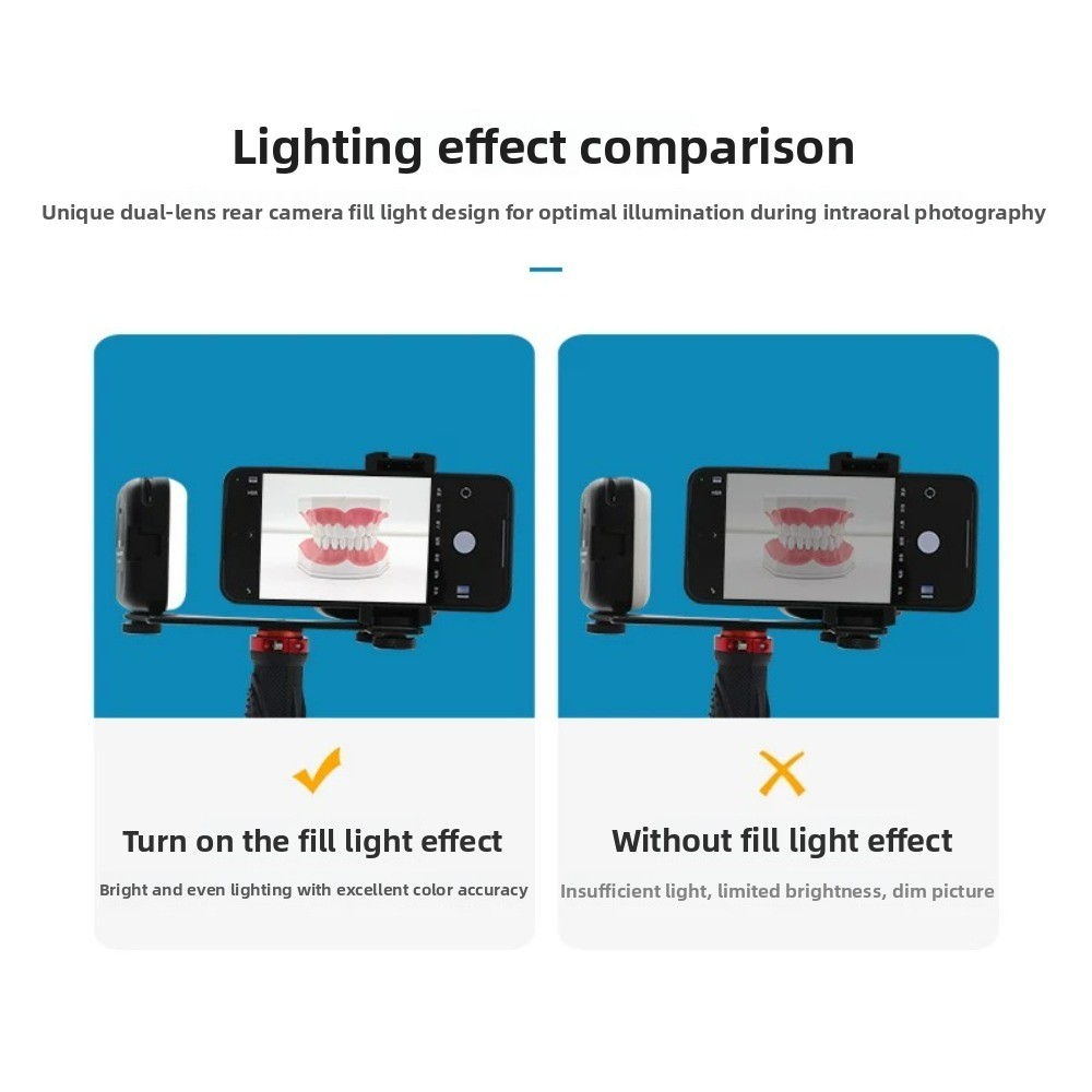 Dental Photography Light, Blue - Teeth Whitening Kit review and price