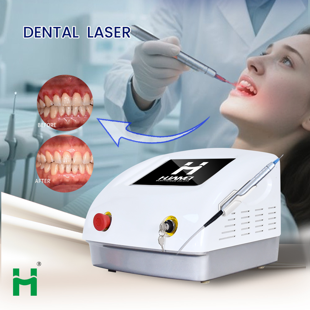 Portable LED Teeth Whitening K - Teeth Whitening Bleaching Kit review and price